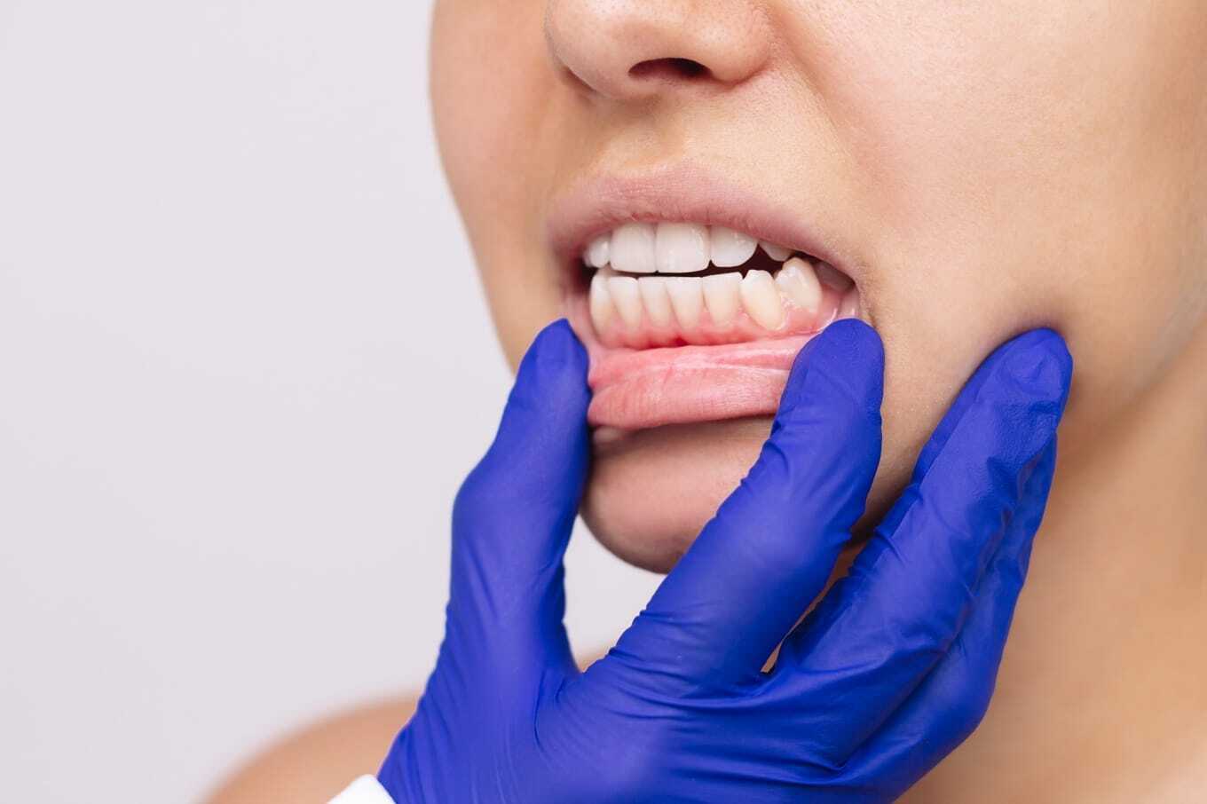 Dentysta a zdrowie ogólne – dlaczego stan jamy ustnej wpływa na cały organizm?